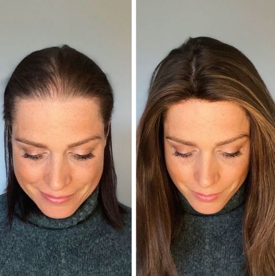 Hair Growth Accelerator - with Lustriva® - Image 10