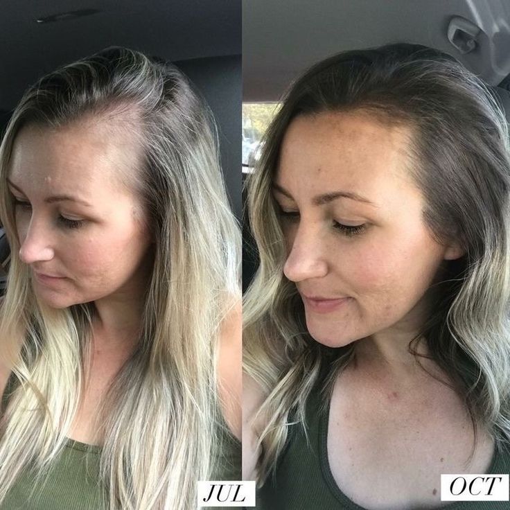 Hair Growth Accelerator - with Lustriva® - Image 9