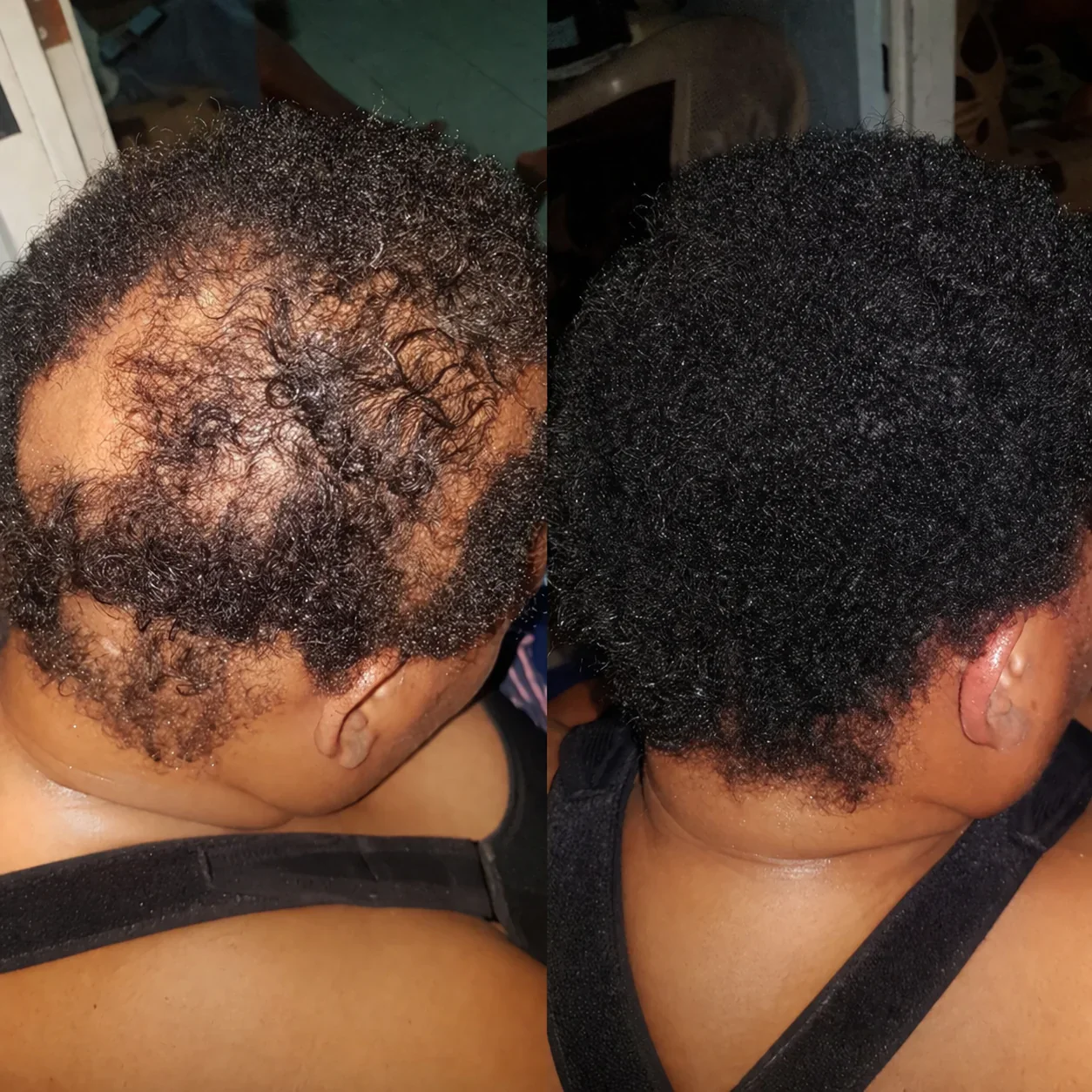 Root Revive - Hair Growth Capsules - Image 2