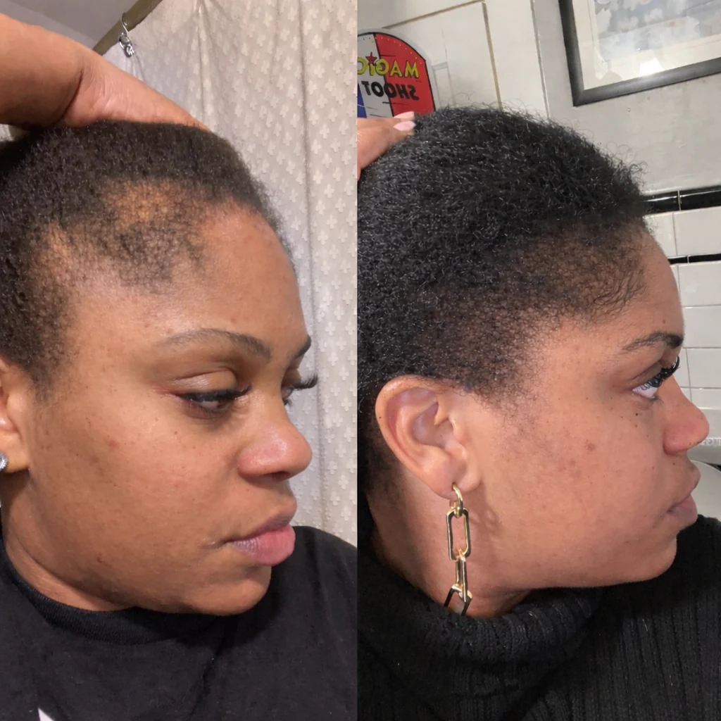 Hormone Hair Revive: 2+1 FREE - Image 3